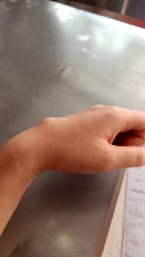 手背硬肿块怎么回事?