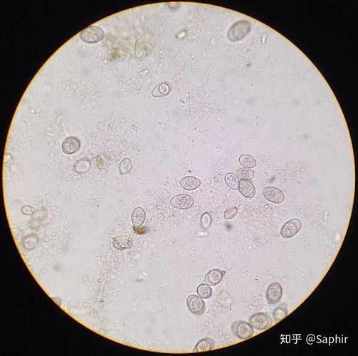 显微镜下的球虫卵囊