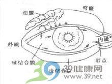 眼结膜上出现瘀点