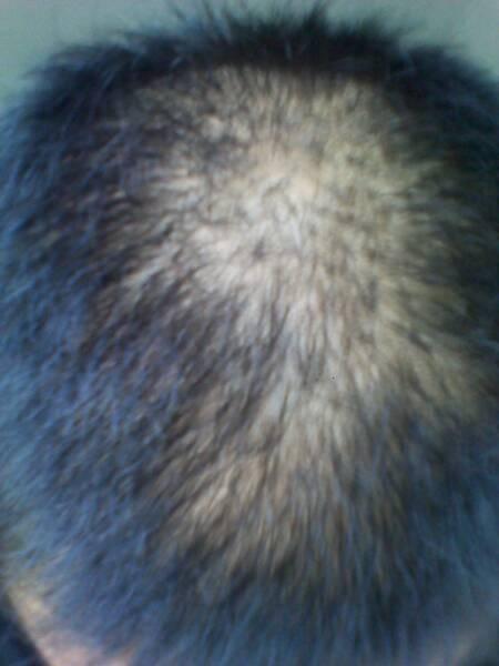 郑州女大学生为树木手织新毛衣,头发稀少的男同学不答应了:可以为我们