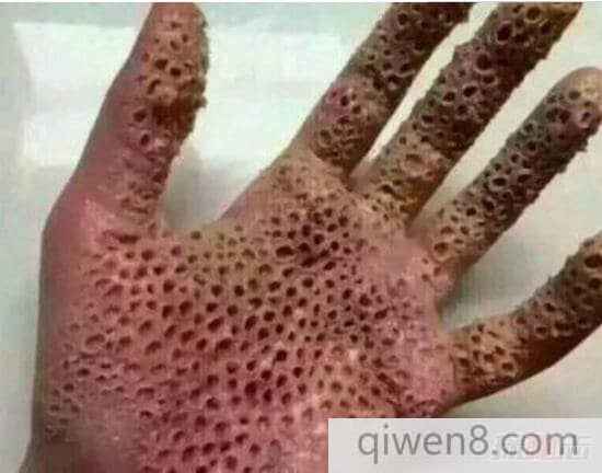 密集恐惧症患者请不要看,十宗罪中的玉米男孩是怎么回事?