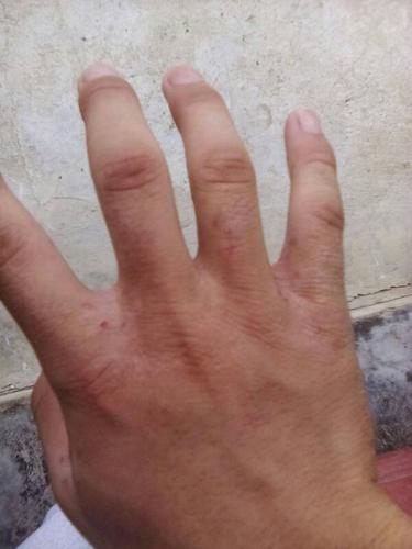 我这是不是干疮