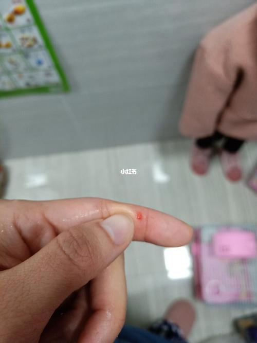 被仓鼠咬了,流血了,需要打针吗_仓鼠_疫苗_医疗健康