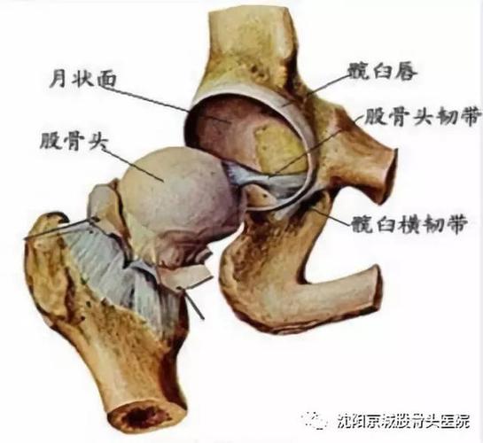 股骨头呈圆形,由皮质骨外壳和松质骨构成,相对脆弱,股骨头朝向前上方