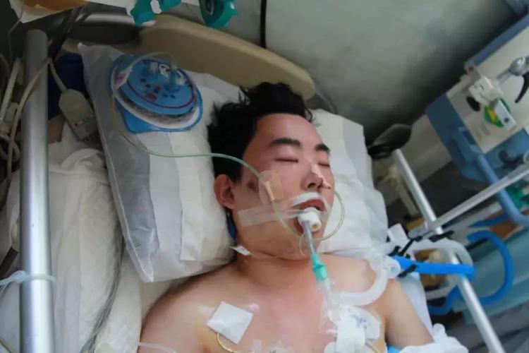 西街与安顺路交叉口南200米路东发生车祸,导致头颈部外伤,意识丧失