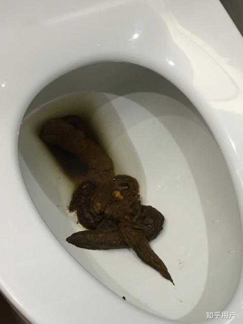 如何拉出一根50cm长的屎?