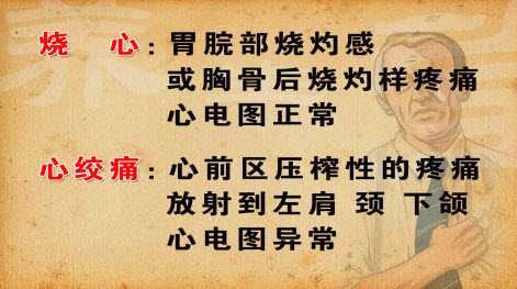 如何区分烧心与心绞痛