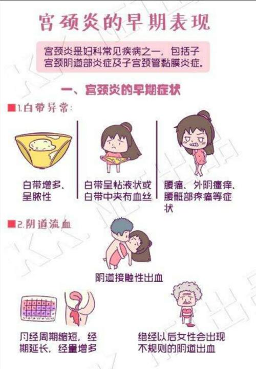 宫颈糜烂等同于宫颈炎吗