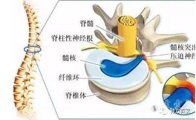椎管内软组织损害性疼痛征象与检查
