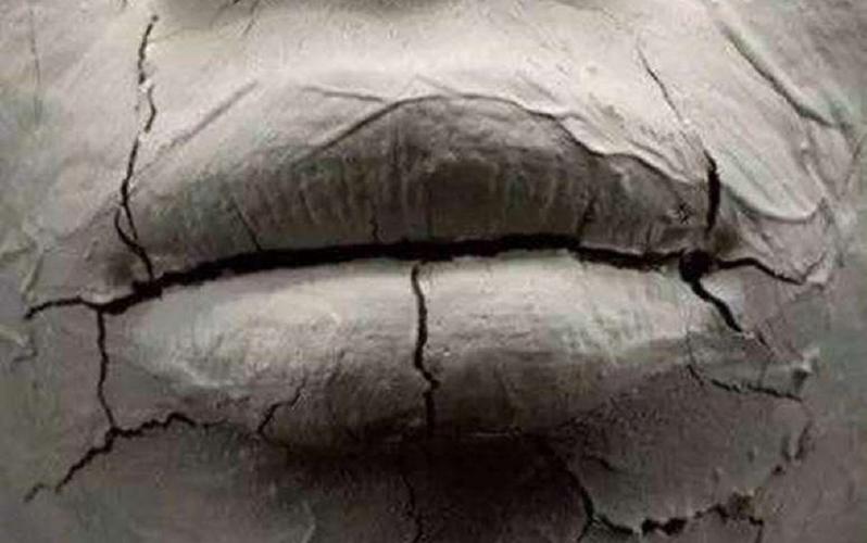 冬季嘴唇干裂?以下几个妙招,不妨试试