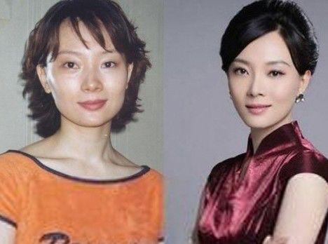 陈数整容前后对比