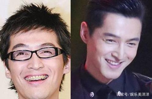 盘点娱乐圈带过牙套的明星,前后变化太大,果然整牙相当于整容