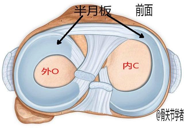 磁共振报告提示半月板损伤并不代表你半月板真的有损伤