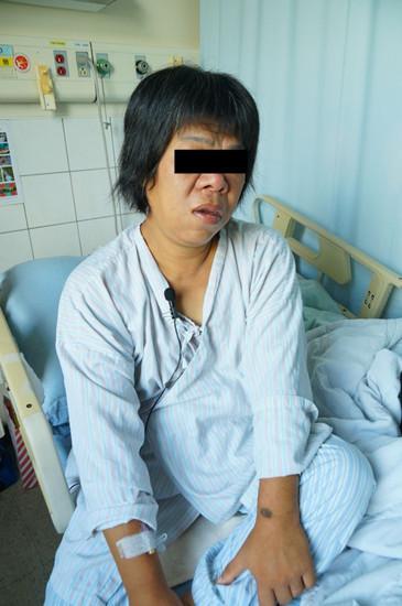 女子患肢端肥大症后变脸 舌鼻变大还掉牙(图)