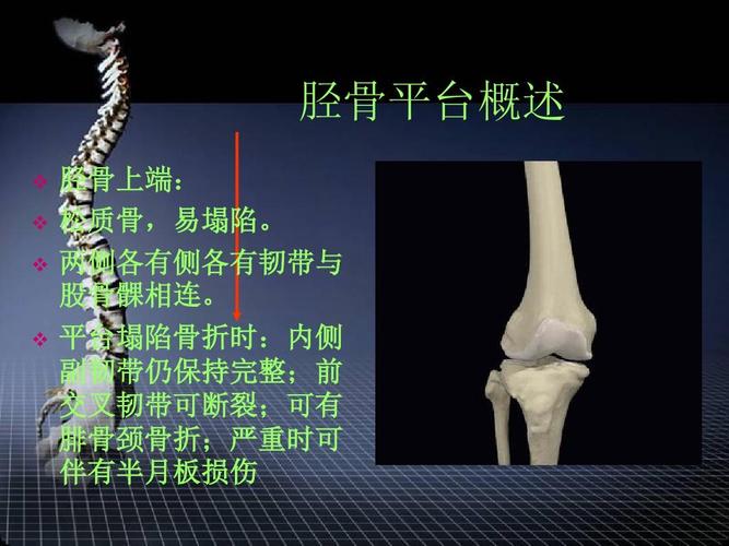 你好,我是左胫骨髁间山脊骨折,现在手术用钢丝固定,手术已经三个星期