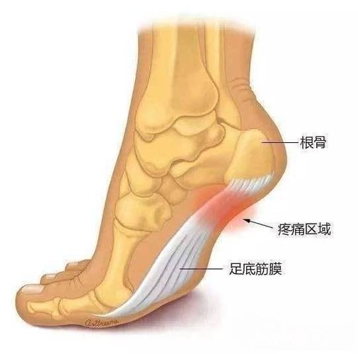 足跟痛不能碰地?3个运动方法,通络止痛