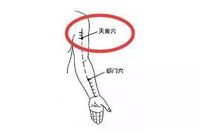 4,天泉穴