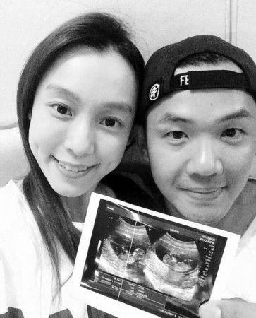 范玮琪晒双胞胎宝贝b超照(图)