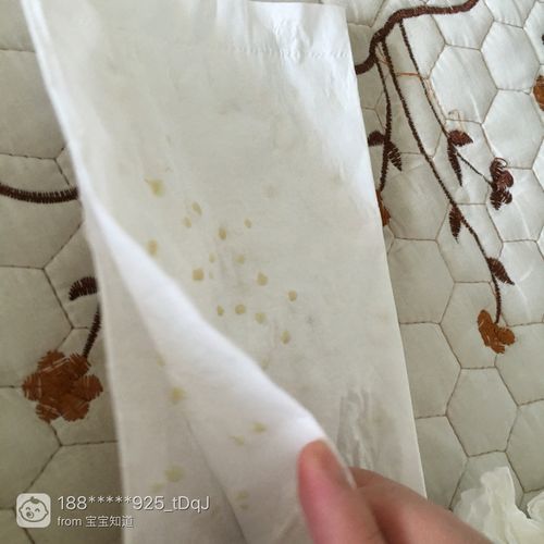 宝宝三个月母乳,突然有乳腺炎,里面有硬块,怎么办,痛!