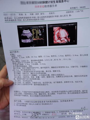 看肚型和四维彩超单能看出男宝女宝么?