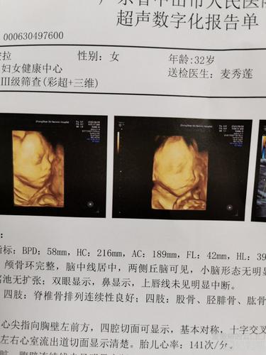 24周四维彩超出炉