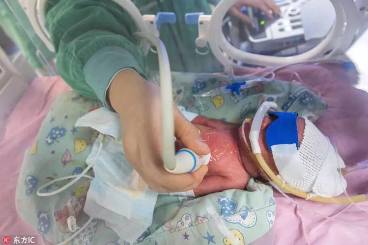 母婴 正文 "第一次发作的时候,胎儿只有30周,属于早产,在母子稳定的