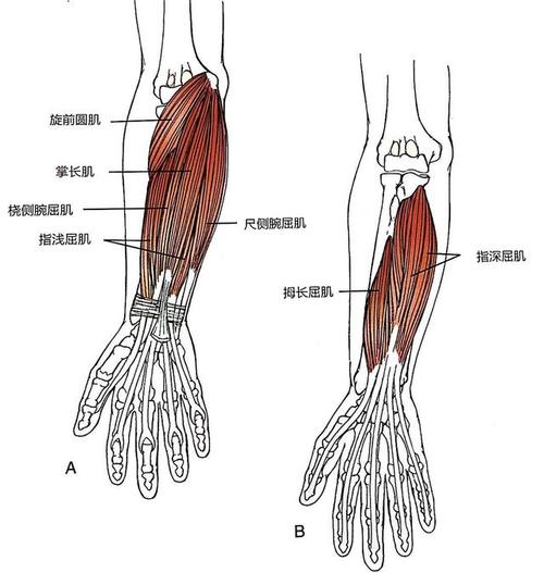 手麻也许是旋前圆肌综合征!与腕管综合征,神经根型颈椎病有区别