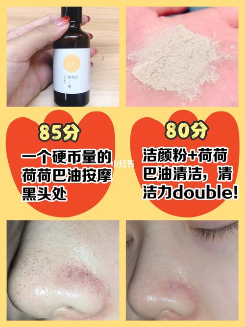 脸上这么多小疙瘩原来是毛周角化!