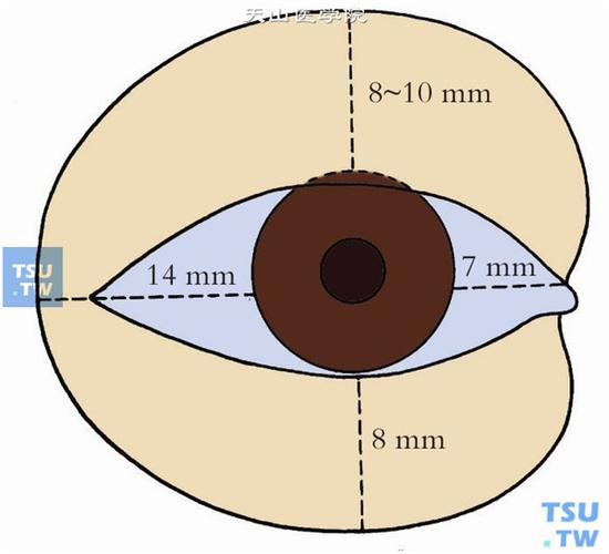 穹窿结膜又分为:上穹窿,下穹窿,外侧穹窿和内侧穹窿.