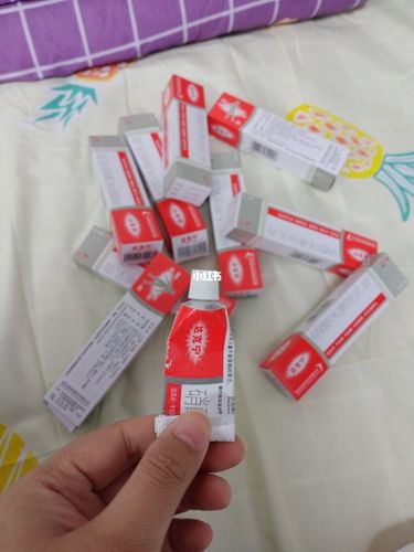 是谁说达克宁,坚持涂就能去脚气的?_脚气_夏天去哪玩