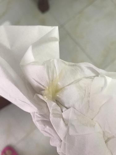 有图慎入帮我看下这样的白带是水样还是脓样