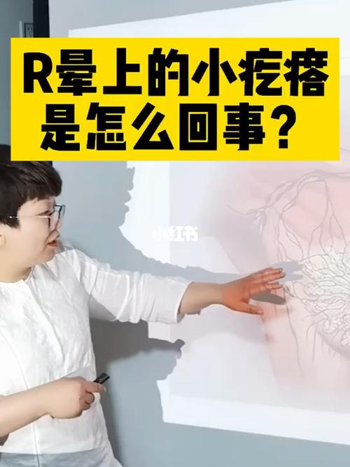 孕期科普～蒙氏结节_孕期_蒙氏_孕期日记_怀孕_母婴
