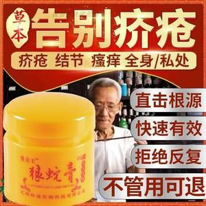 疥疮膏一扫光