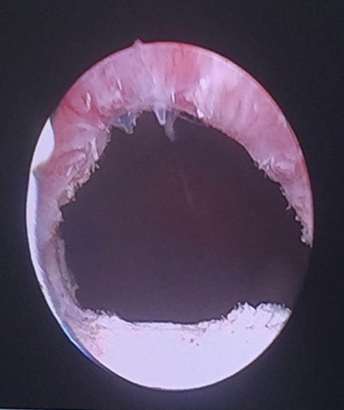 疑难病例手记(四)