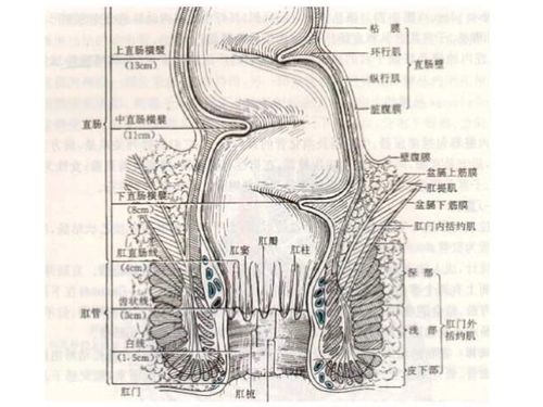 肛瘘为什么不能自愈,需要手术治疗?