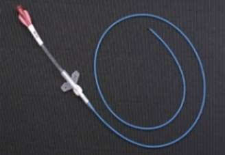 何为picc: picc是指经外周静脉穿刺置入中心静脉导管,为患者提供中