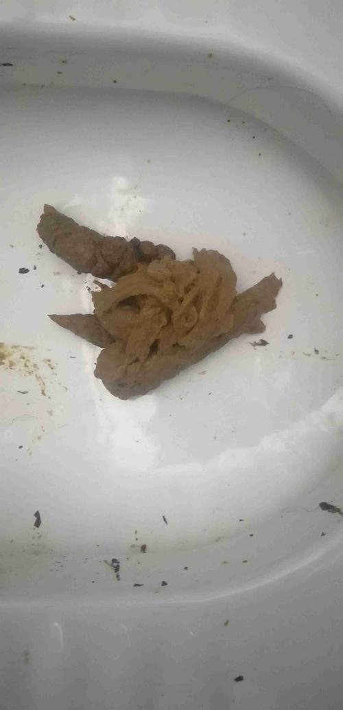 每次大便都这样