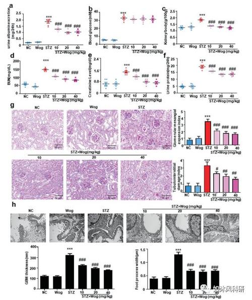 15:汉黄芩素通过靶向bcl-2介导的凋亡和自噬串话减轻糖尿病肾病足细胞