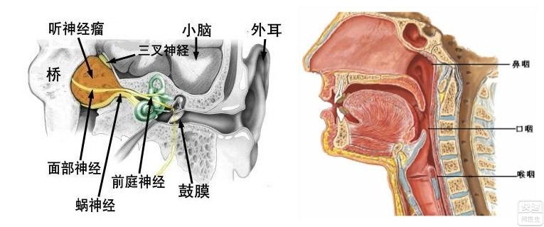 听神经瘤和鼻咽癌区别有哪些