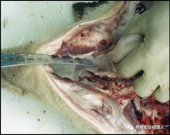 整个扁桃体化脓怎么办