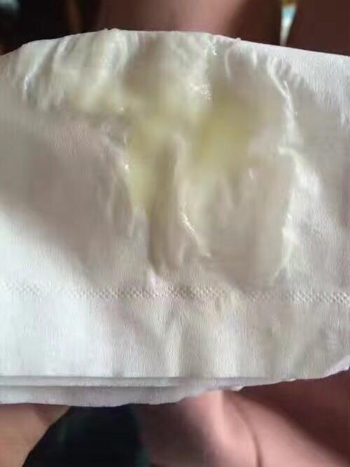 预警:宫颈癌,子宫黏膜下肌瘤等.