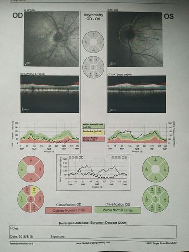 天水市中医医院眼科开展oct检查