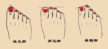  p>希腊脚(greek foot)又称莫顿趾(morten"s toe),一种常见的足前部