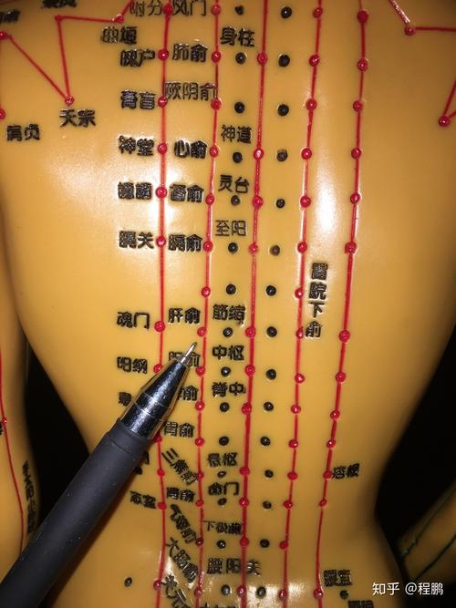 为什么要在背部拔罐?