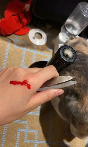 林允深夜开红酒划伤手,伤口血迹清晰可见惹心疼