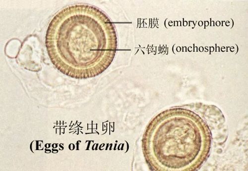 绦虫的结构有: 1,头节 2,成熟节片 3,妊娠节片 4,虫卵