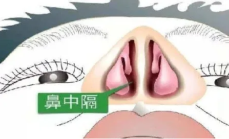 你一定要知道90的人都有鼻中隔偏曲必须要手术吗