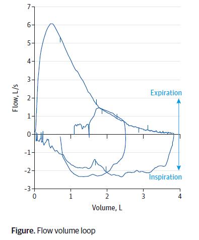 从一则病例学习肺功能检查