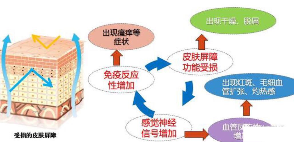 韩之媚|治疗敏感肌(敏感性皮肤),修复受损的皮肤屏障是关键!