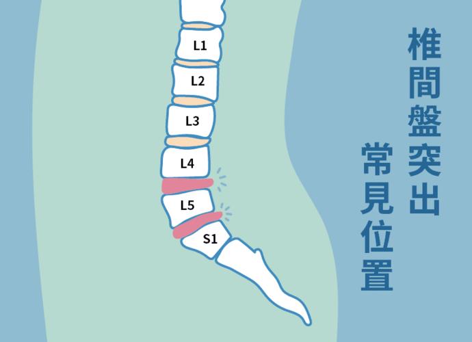 一,腰椎间盘的位置与作用